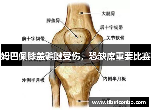 姆巴佩膝盖髌腱受伤，恐缺席重要比赛